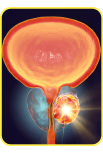 Prostate Health
